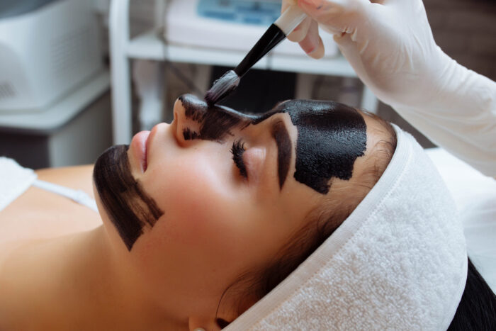 Peeling de carbon activado con láser - Hollywood Peel